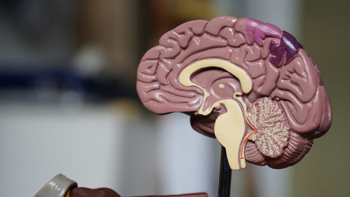 A plastic model of the human brain against a dark background.
